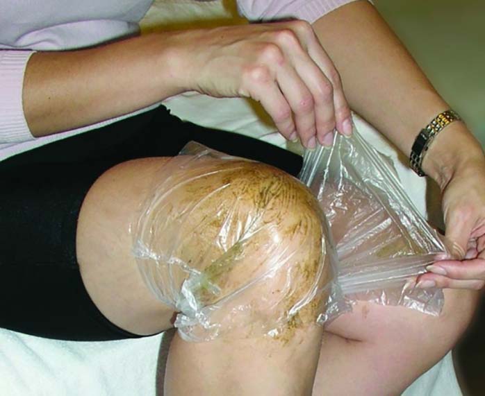 Knee